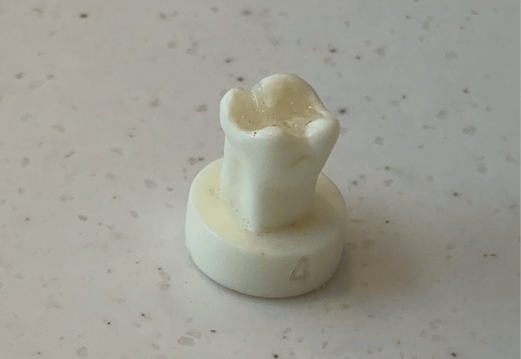 歯の模型とセラミックの詰め物